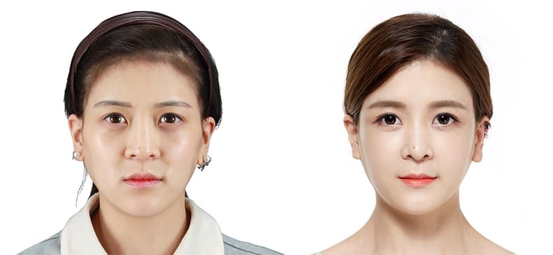 Slider image (2) JK Plastic Surgery Korea Aesthetic Surgery Clinic